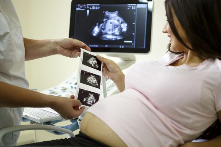 怀孕一般做几次B超 怀孕一般做几次b超能看出来-www.3hqz.com